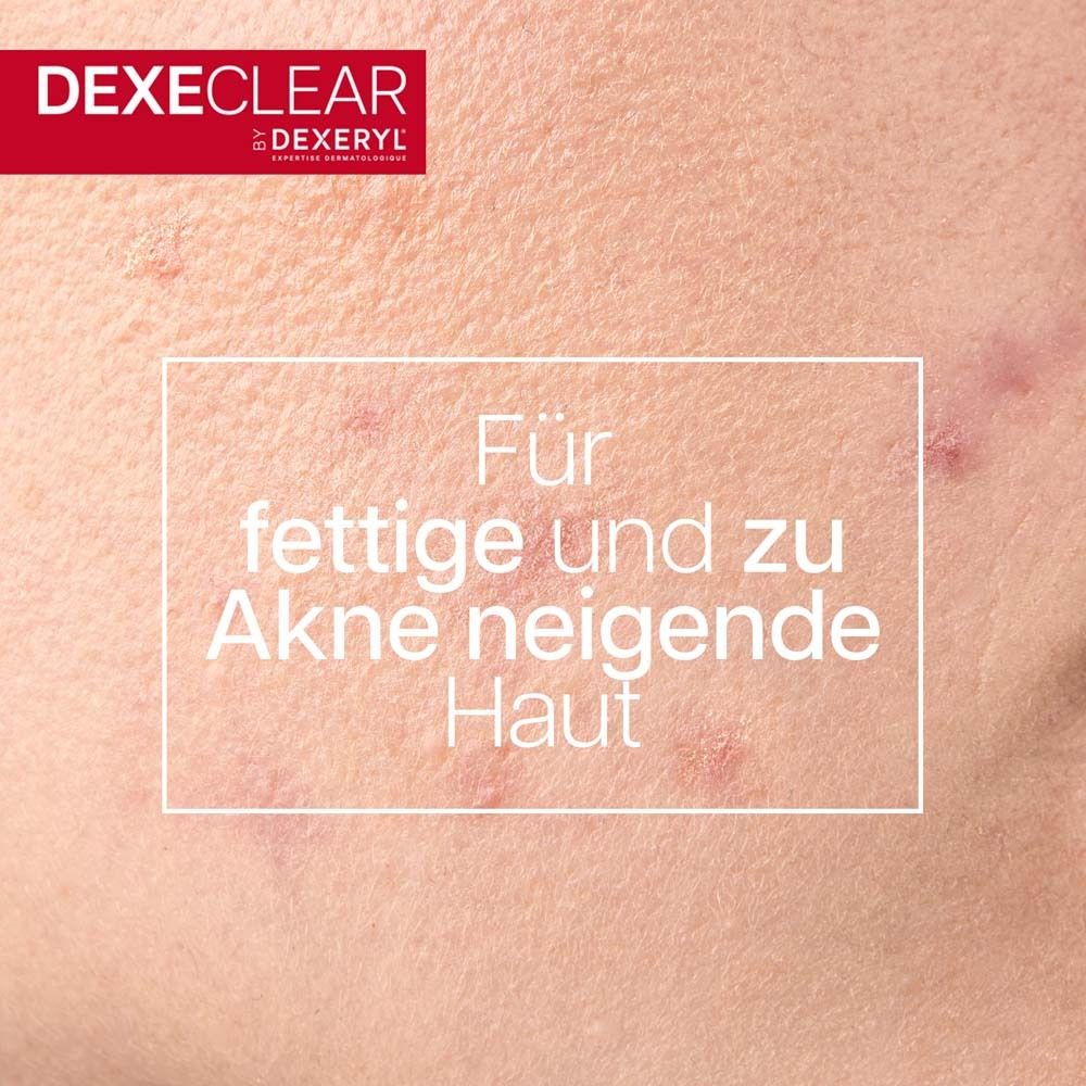 Nahaufnahme von Haut mit Pickeln. Text: Für fettige und zu Akne neigende Haut.
