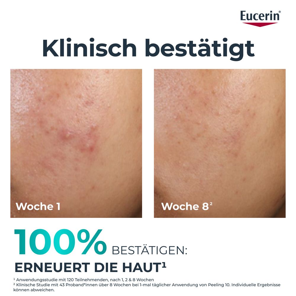 Gesicht mit Hautunreinheiten. Text: Klinisch bestätigt. Woche 0 und Woche 8. Text: Erneuert die Haut.