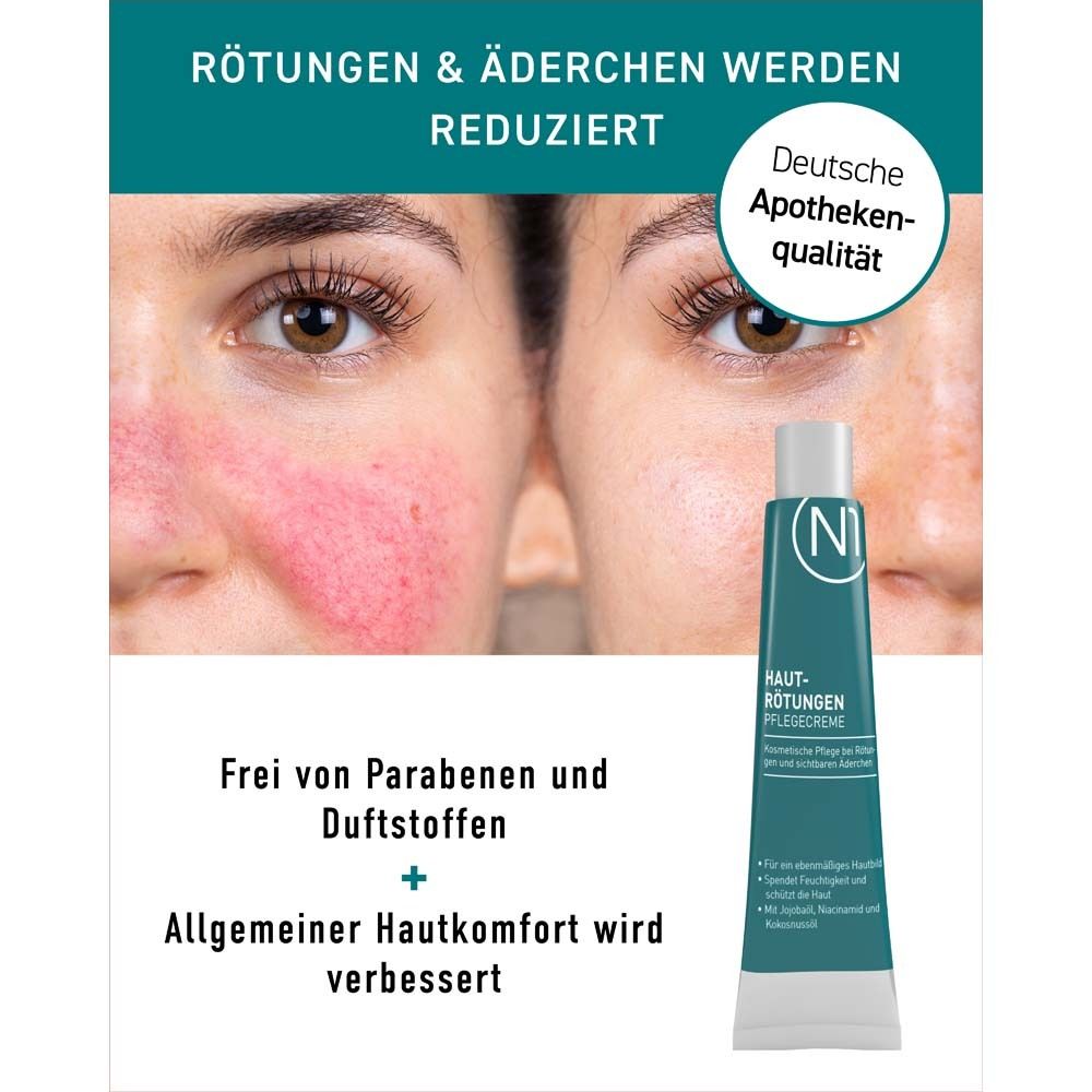 Vergleichsbild: Rötungen vor und nach der Anwendung. Text: Rötungen & Äderchen werden reduziert. Deutsche Apothekenqualität.
