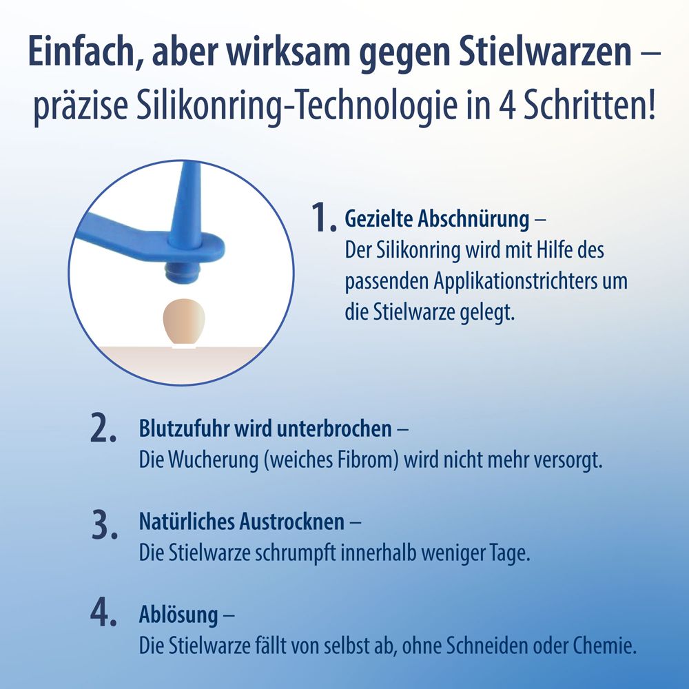 Anleitung zur Anwendung von Evolsin Anti Stielwarze. 4 Schritte zur Entfernung von Stielwarzen.