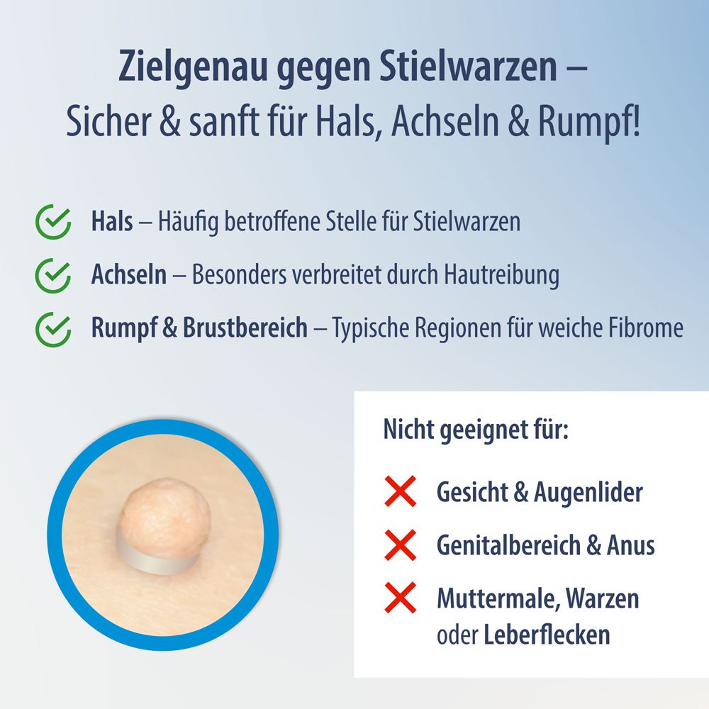 Evolsin Anti Stielwarze: Geeignet für Hals, Achseln, Rumpf. Nicht für Gesicht, Genitalbereich.