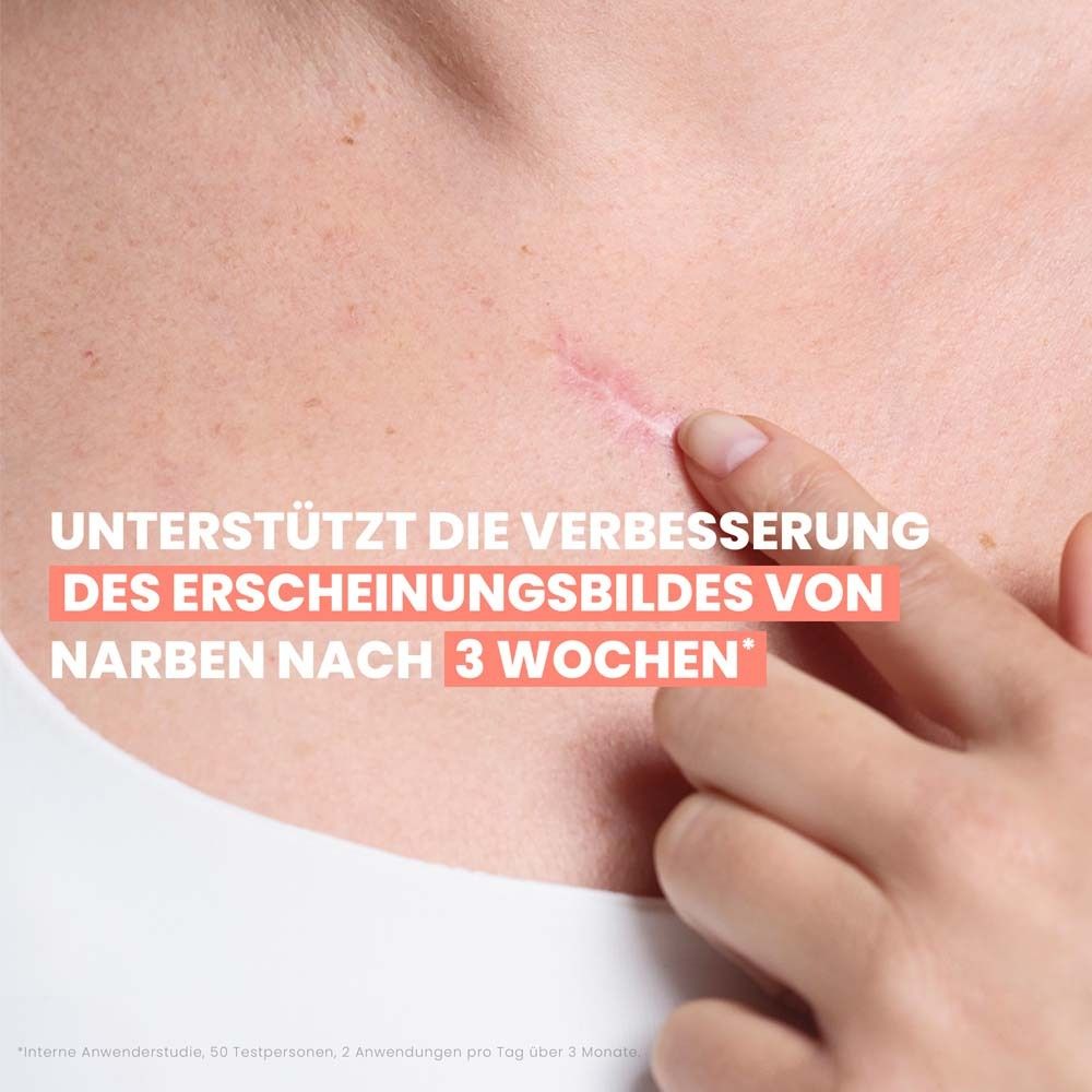 Haut mit Narbe. Text: Unterstützt die Verbesserung des Erscheinungsbildes von Narben nach 3 Wochen.