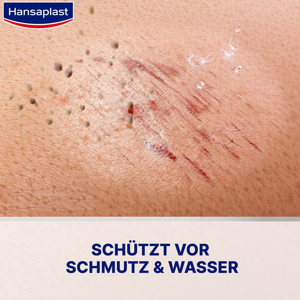 Nahaufnahme einer Hautverletzung. Sichtbar sind Kratzer und kleine Wunden. Text: Schützt vor Schmutz & Wasser.
