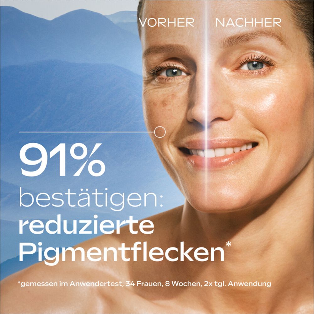 Gesicht einer Frau. Vorher-Nachher-Vergleich. Text: 91% der Frauen zeigen reduzierte Pigmentflecken.