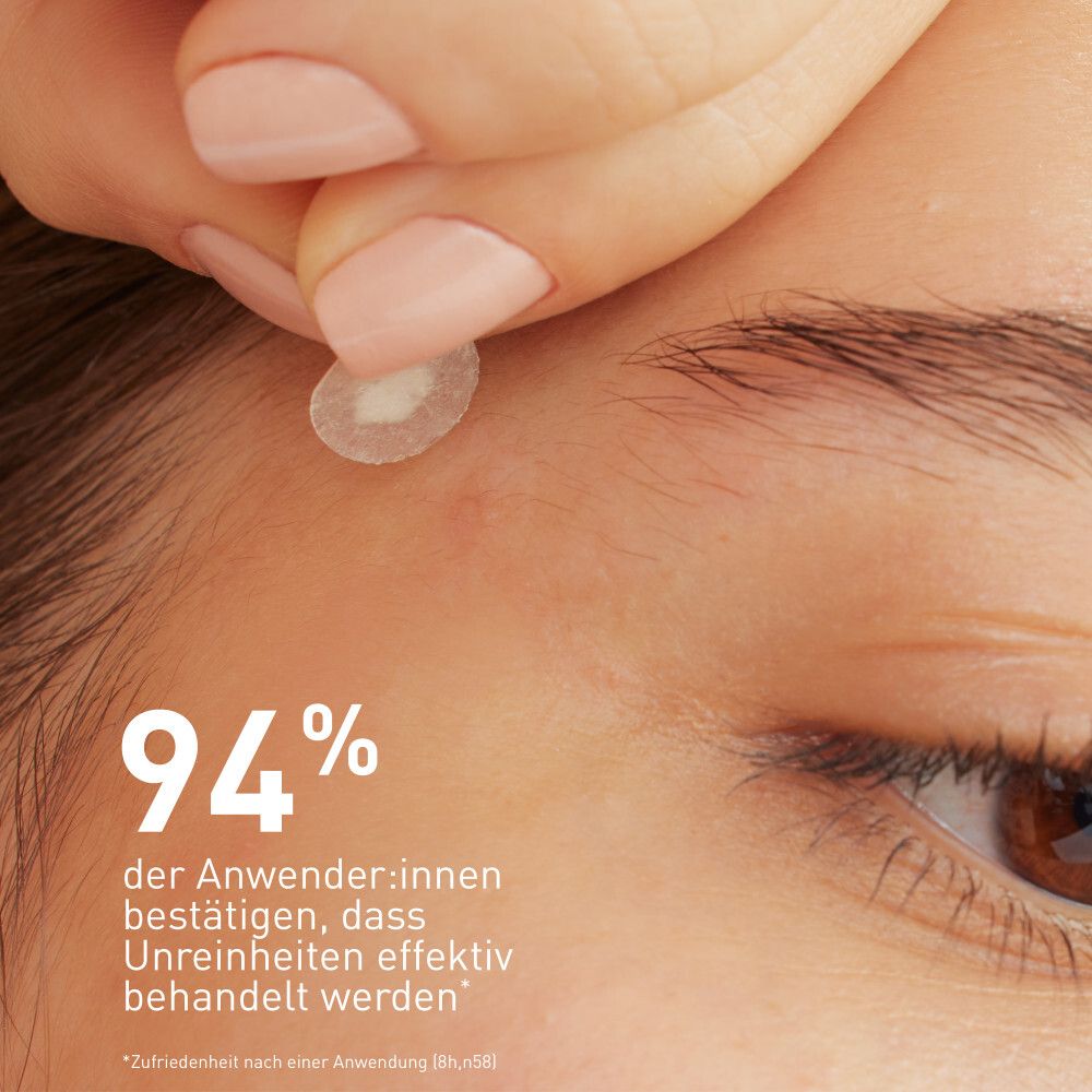 Ein Patch wird auf die Haut aufgetragen. 94% der Anwender bestätigen effektive Behandlung von Unreinheiten.