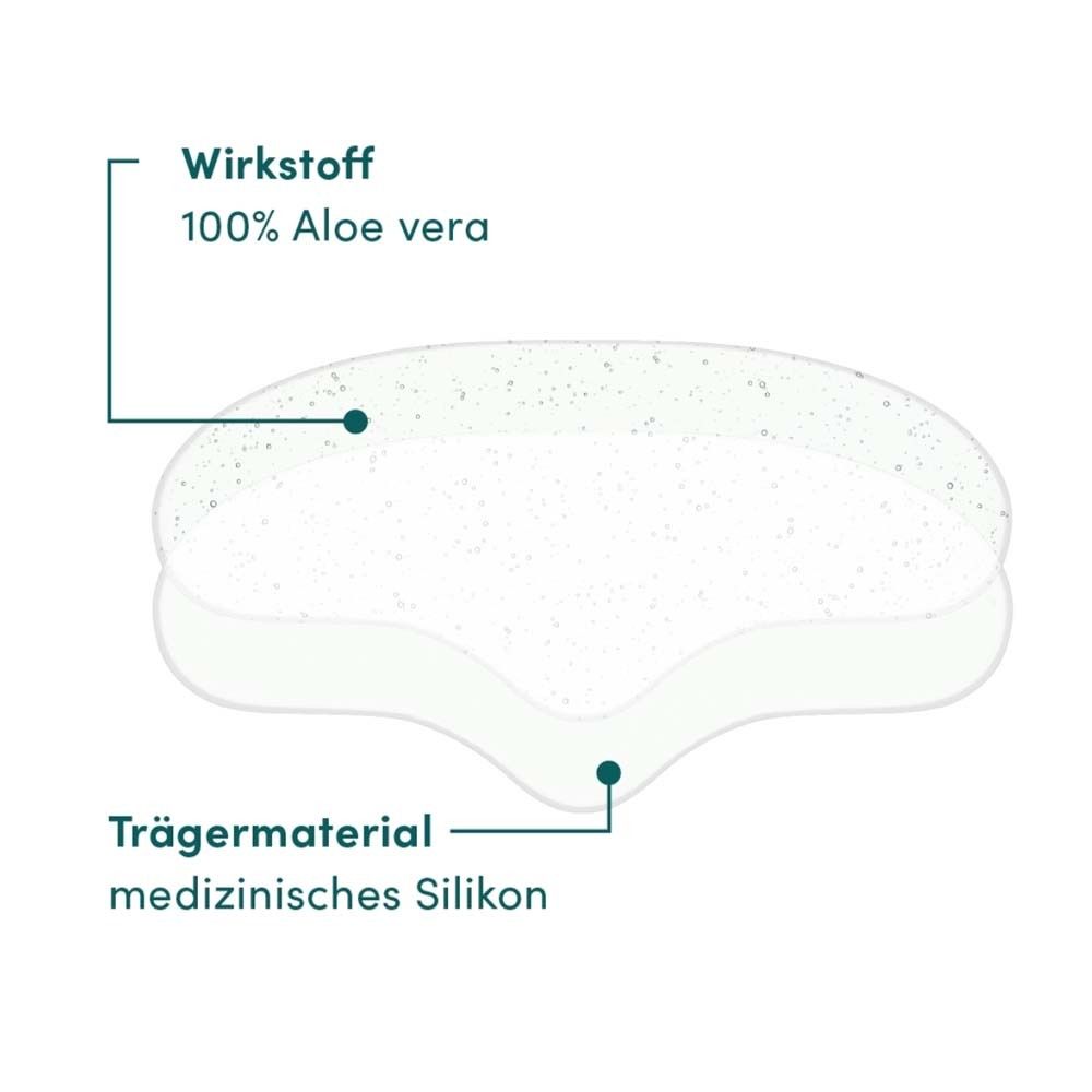 Schnitt durch Stirn Pad. Wirkstoff: 100% Aloe vera. Trägermaterial: medizinisches Silikon.