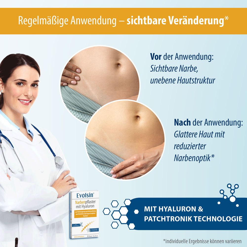Vorher-Nachher-Vergleich. Frau mit glatterer Haut. Produktverpackung: Evolsin Narbenpflaster mit Hyaluron & Patchtronik Technologie.