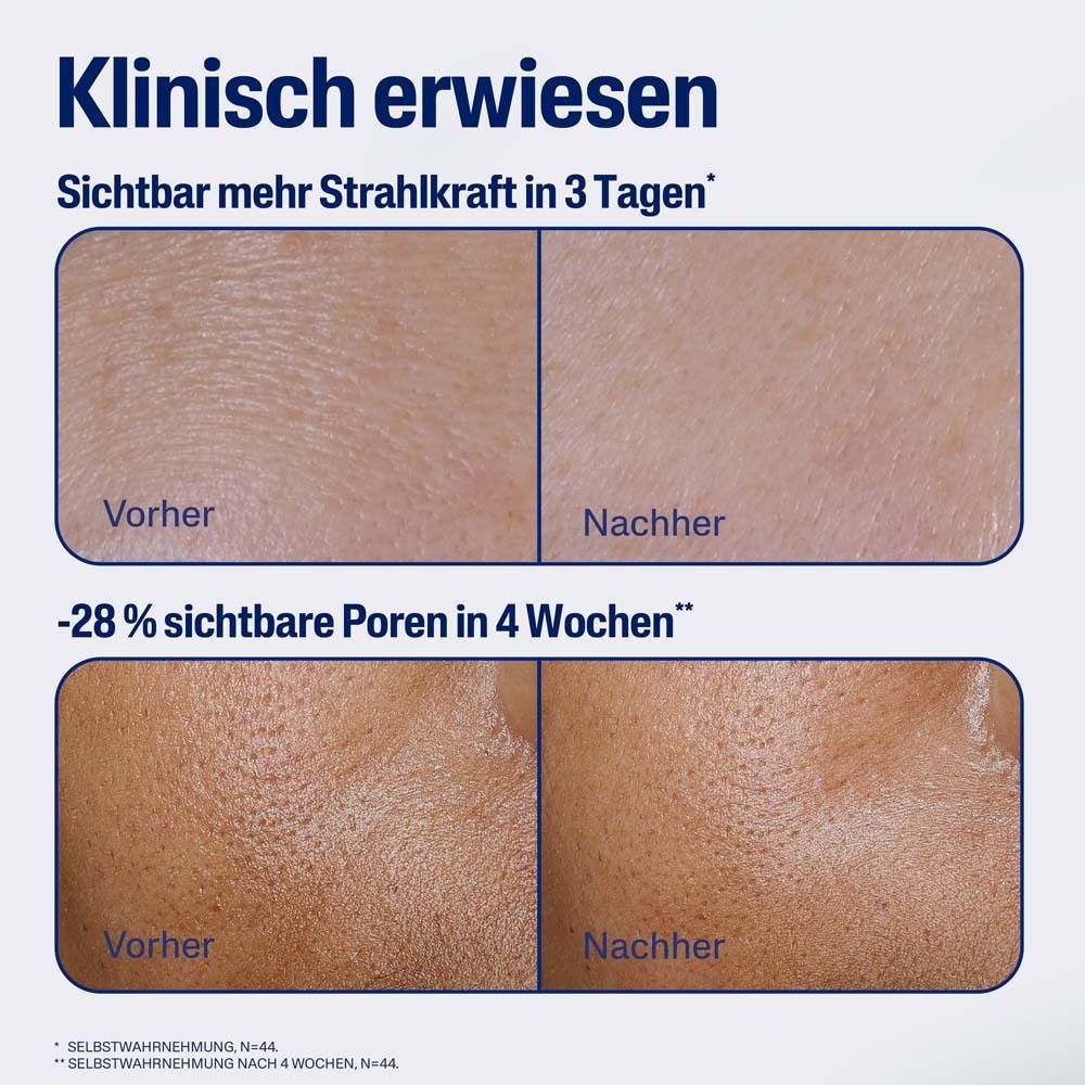 Vorher-Nachher-Vergleich von Haut. Text: Klinisch erwiesen. Sichtbar mehr Strahlkraft in 3 Tagen. -28% sichtbare Poren in 4 Wochen.
