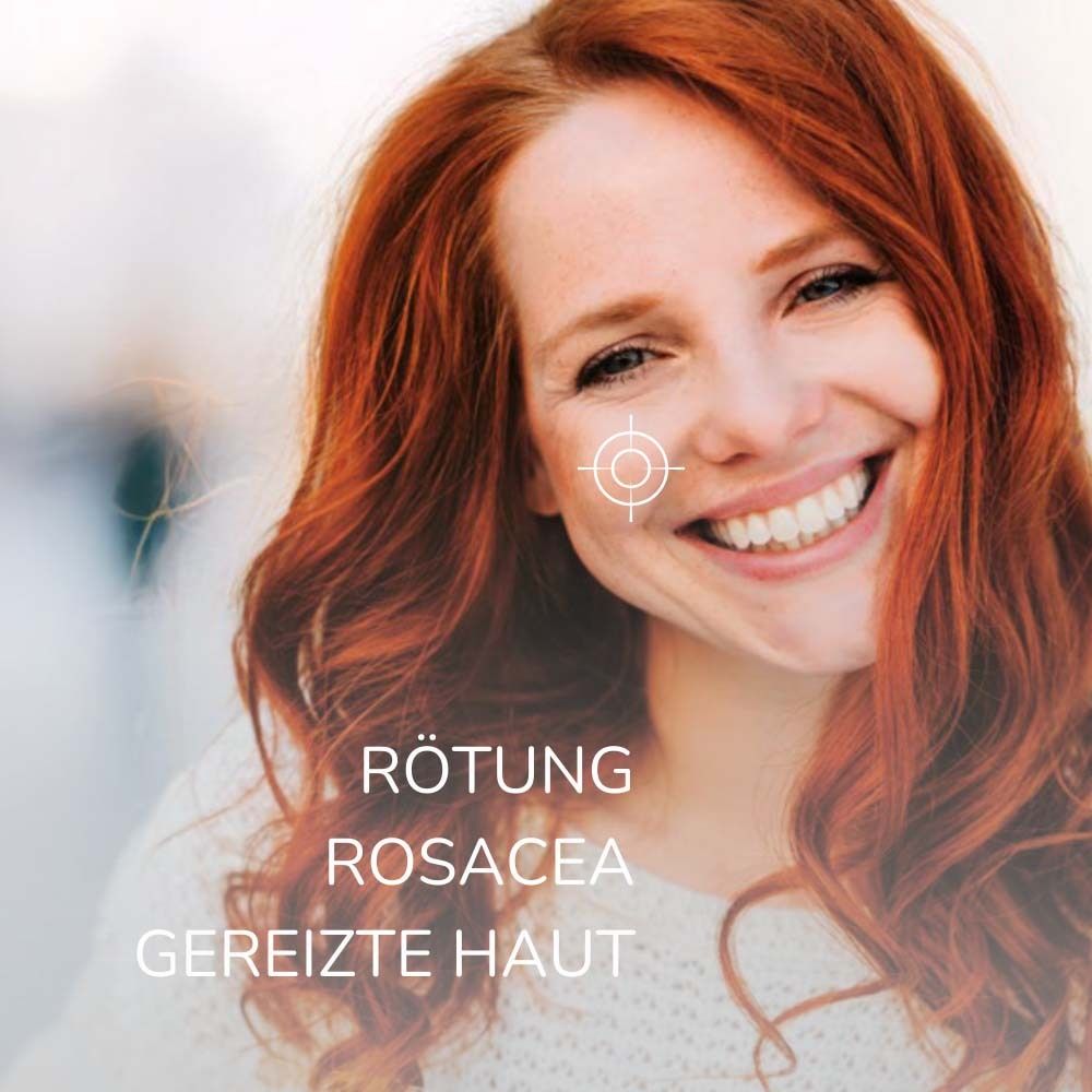 Porträt einer Frau mit Hautrötungen. Text: Rötung, Rosacea, gereizte Haut.