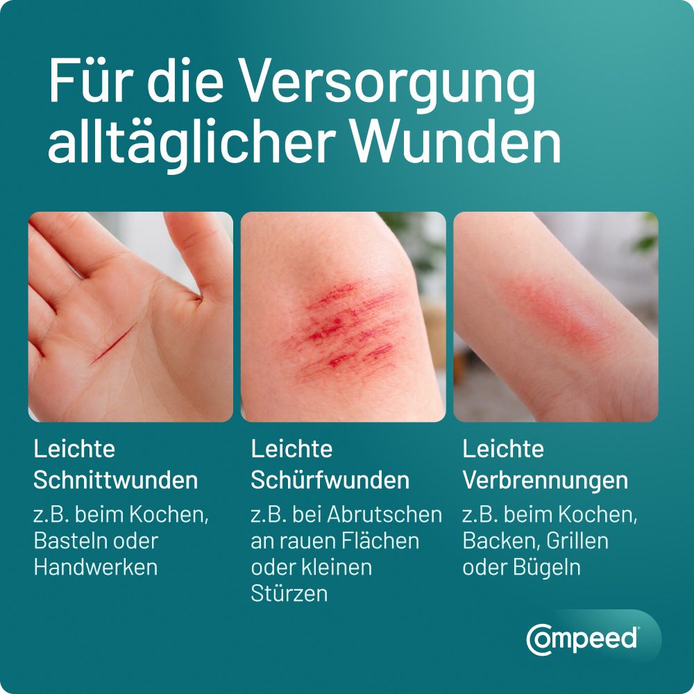 Drei Wunden: Schnittwunde an Hand, Schürfwunden am Arm, leichte Verbrennung am Arm. Compeed Logo.