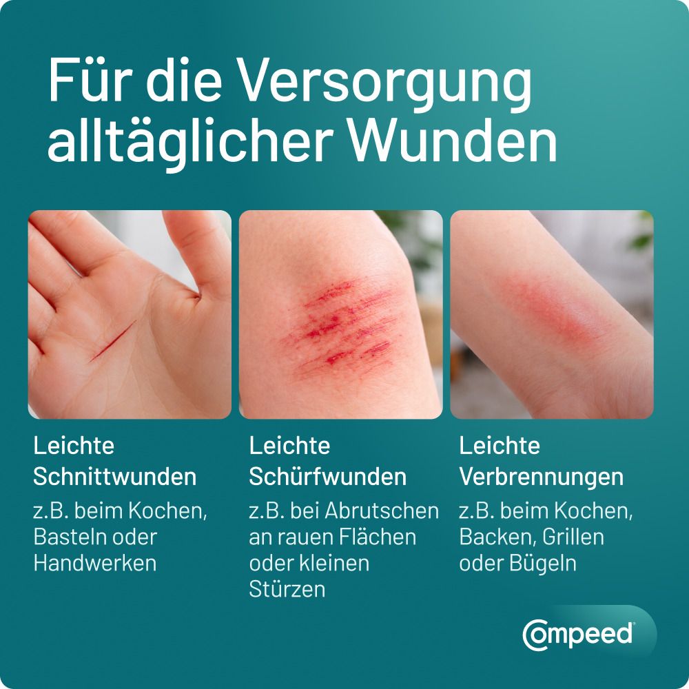 Drei Bilder zeigen verschiedene Wunden: Schnittwunden an der Hand, Schürfwunden am Knie und leichte Verbrennungen am Arm.