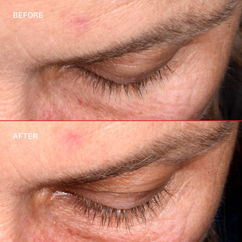 Zwei Nahaufnahmen von Augen. Oben: Vorher. Unten: Nachher. Wimpern sind länger.