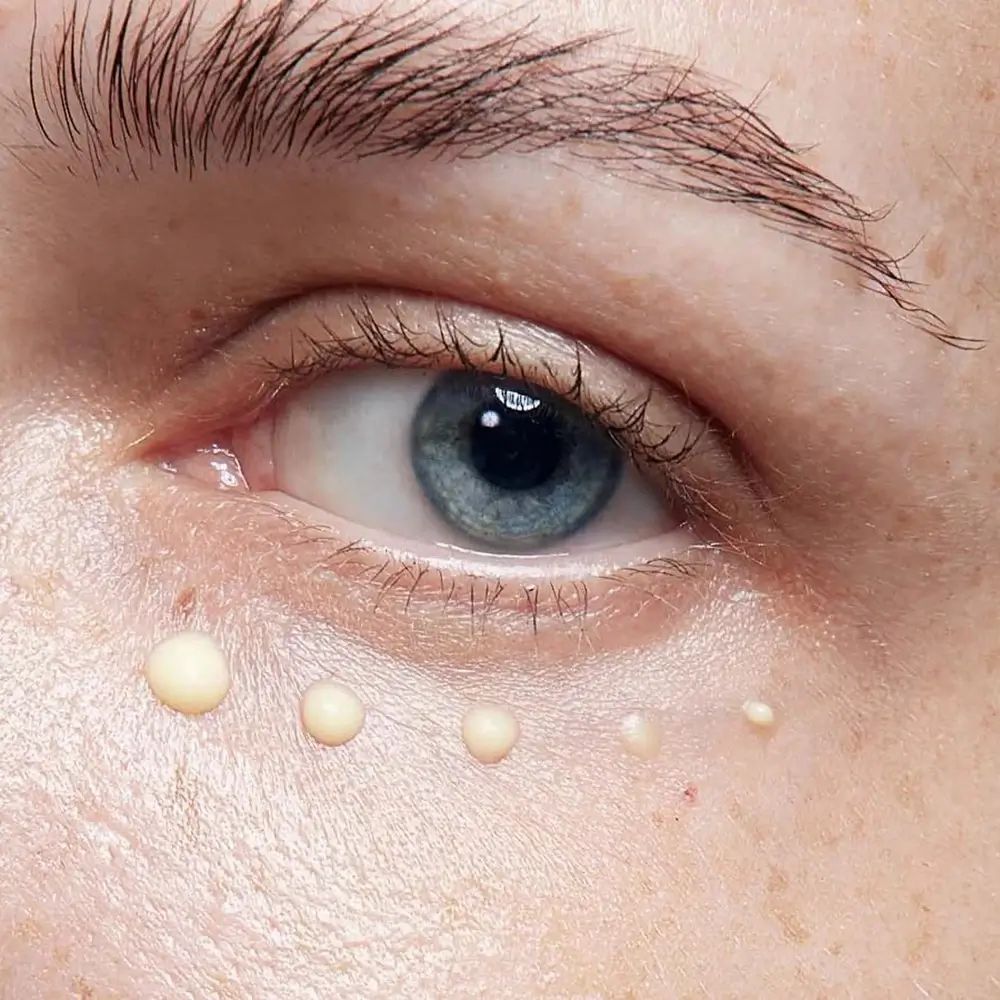 Auge mit Tropfen Creme. Helle, runde Tropfen unter dem Auge. Hautnah-Aufnahme.