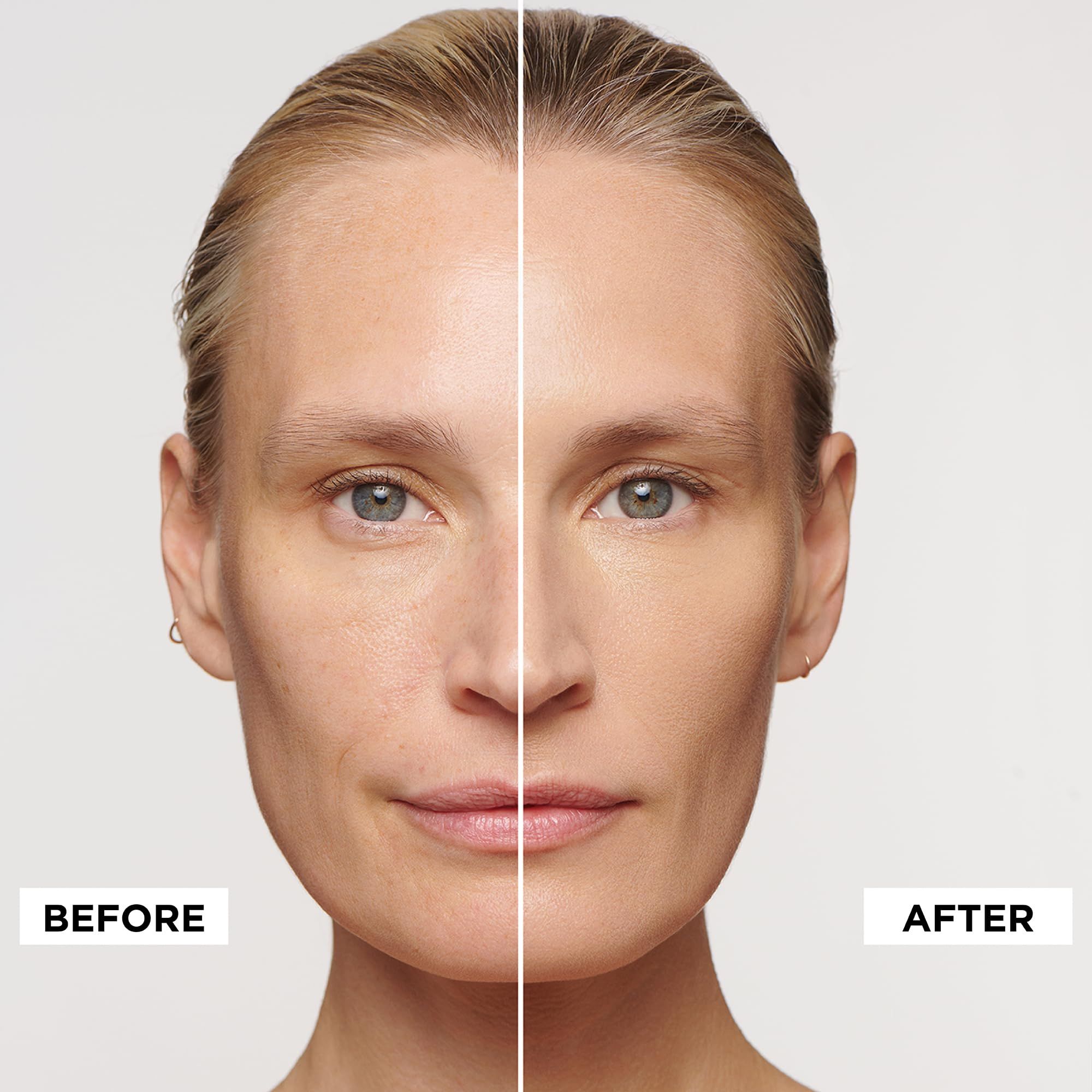 Gesicht einer Frau, geteilt in Vorher-Nachher-Ansicht. Aufschrift: BEFORE und AFTER.