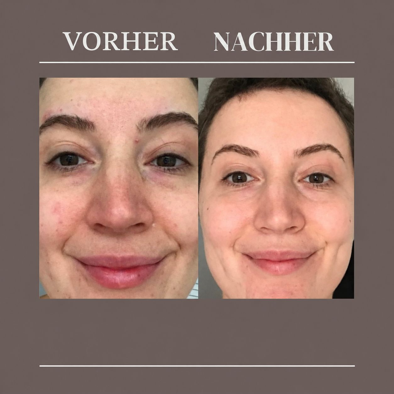 Vorher/Nachher-Vergleich von Gesichtsbehandlungen.
