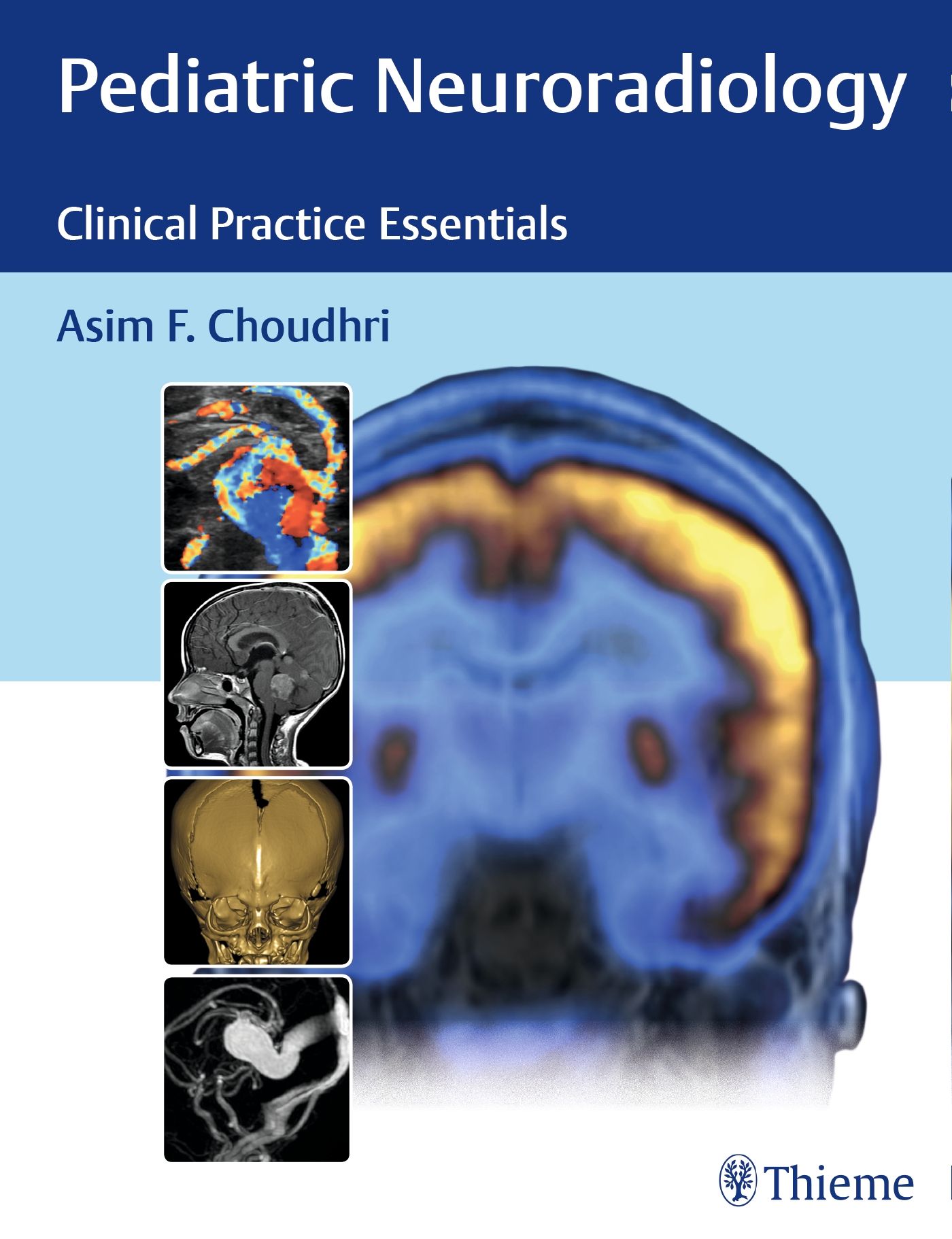 Buchcover: Pediatric Neuroradiology. Titel, Autor und Abbildungen von medizinischen Scans. Logo von Thieme.