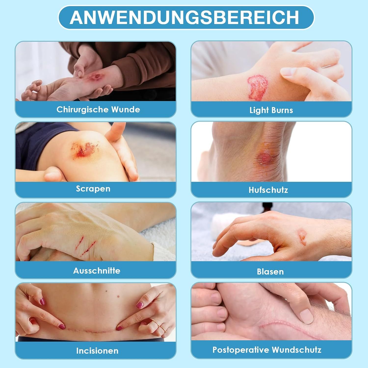 Anwendungsbereich-Diagramm. Bilder zeigen: chirurgische Wunde, leichte Verbrennungen, Schürfwunden, Hufschutz, Schnitte, Blasen, Inzisionen, postoperative Wundversorgung.