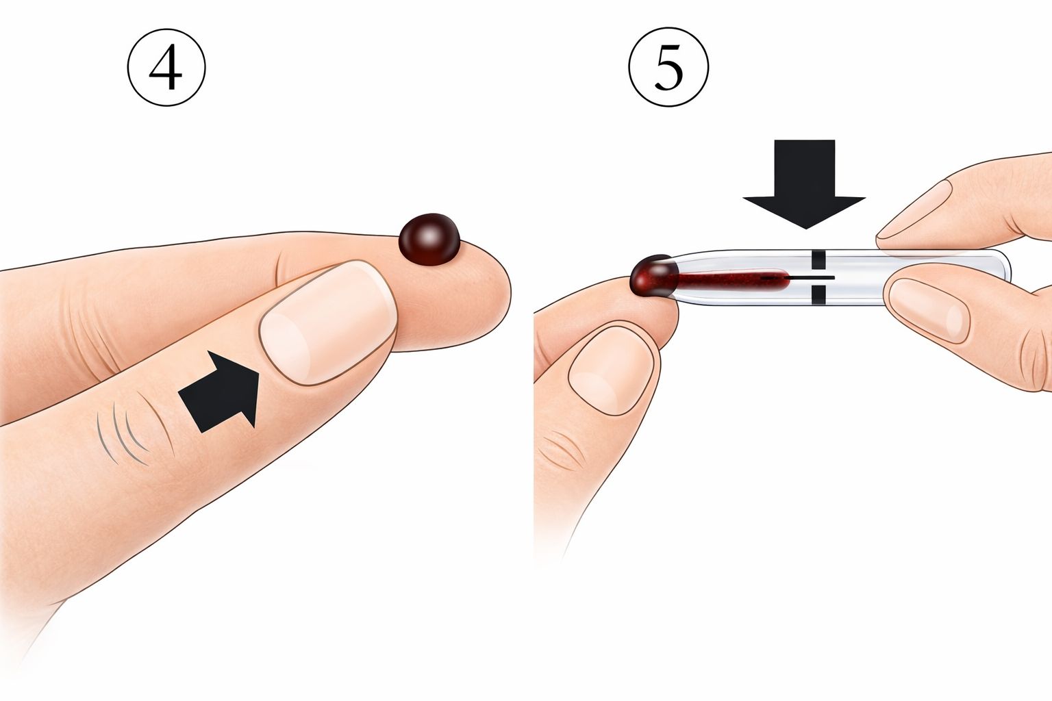 Anleitung zur Verwendung einer Lanzette. Schritte 4-5: Blutstropfen entnehmen, auf Teststreifen auftragen.