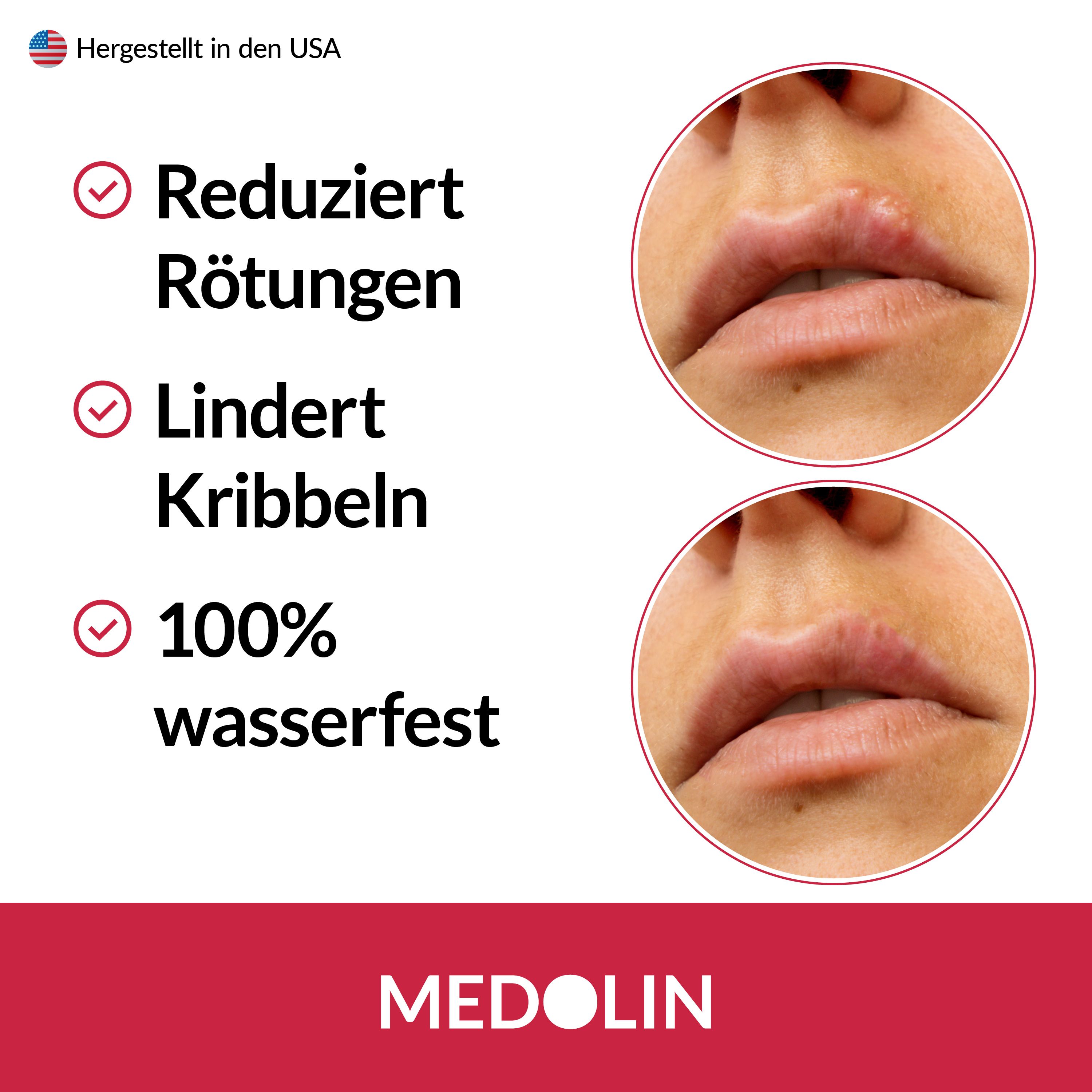 Medolin® Herpes Pflaster - Herpespflaster -  Herpes Patches bei Lippenherpes