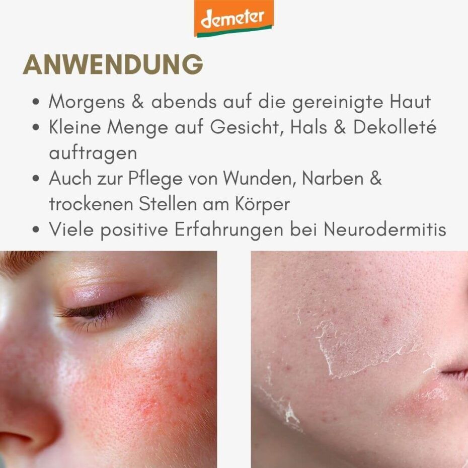 Text über Anwendung: Morgens & abends auf die gereinigte Haut auftragen. Zwei Fotos: Haut mit Rötungen, Haut mit Schuppen. Demeter-Logo.