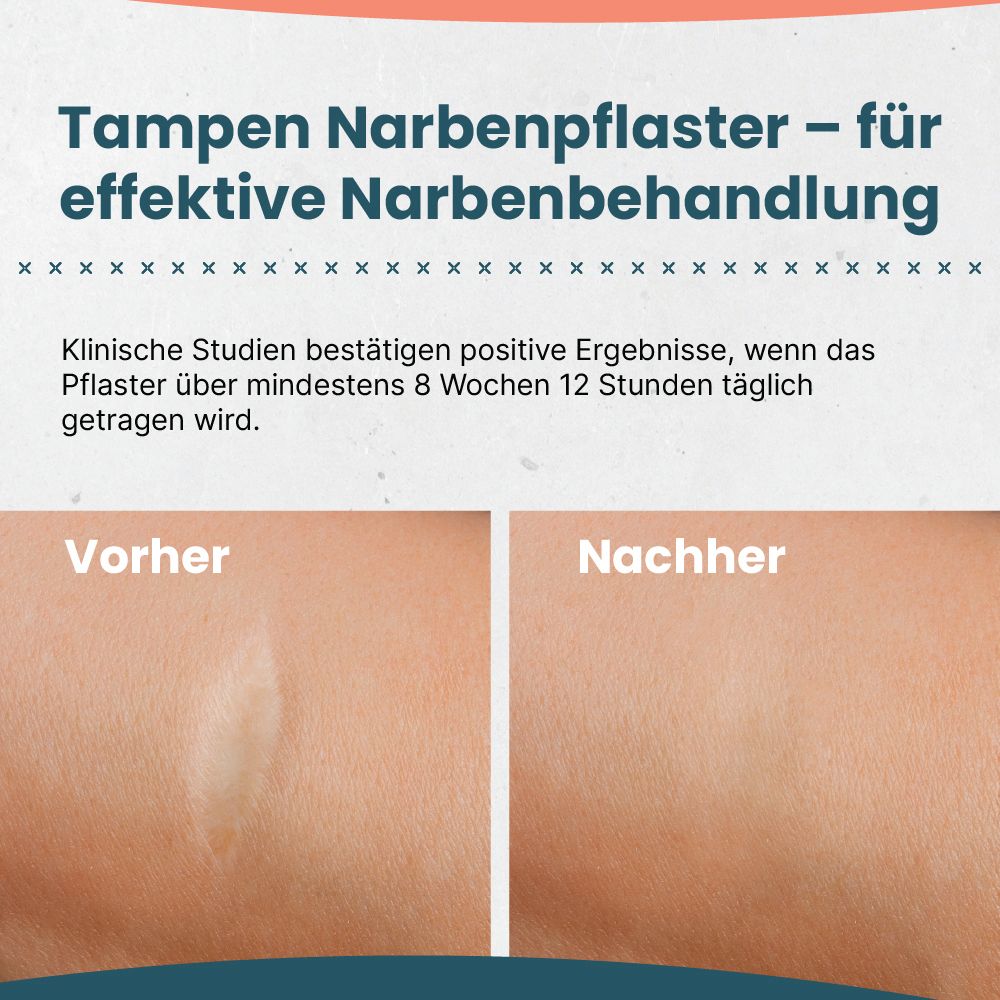 Text zeigt Vorher-Nachher-Vergleich einer Narbenbehandlung. Text: Klinische Studien bestätigen positive Ergebnisse.