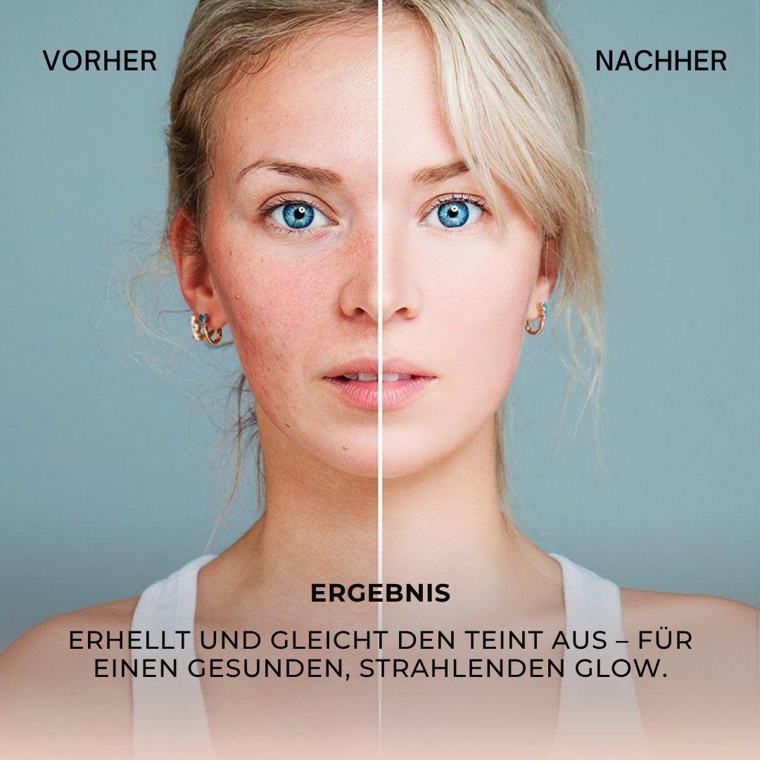 Vorher-Nachher-Bild. Gesicht mit Hautunreinheiten, dann glatte Haut. Text: Ergebnis: Erhellt und gleicht den Teint aus.