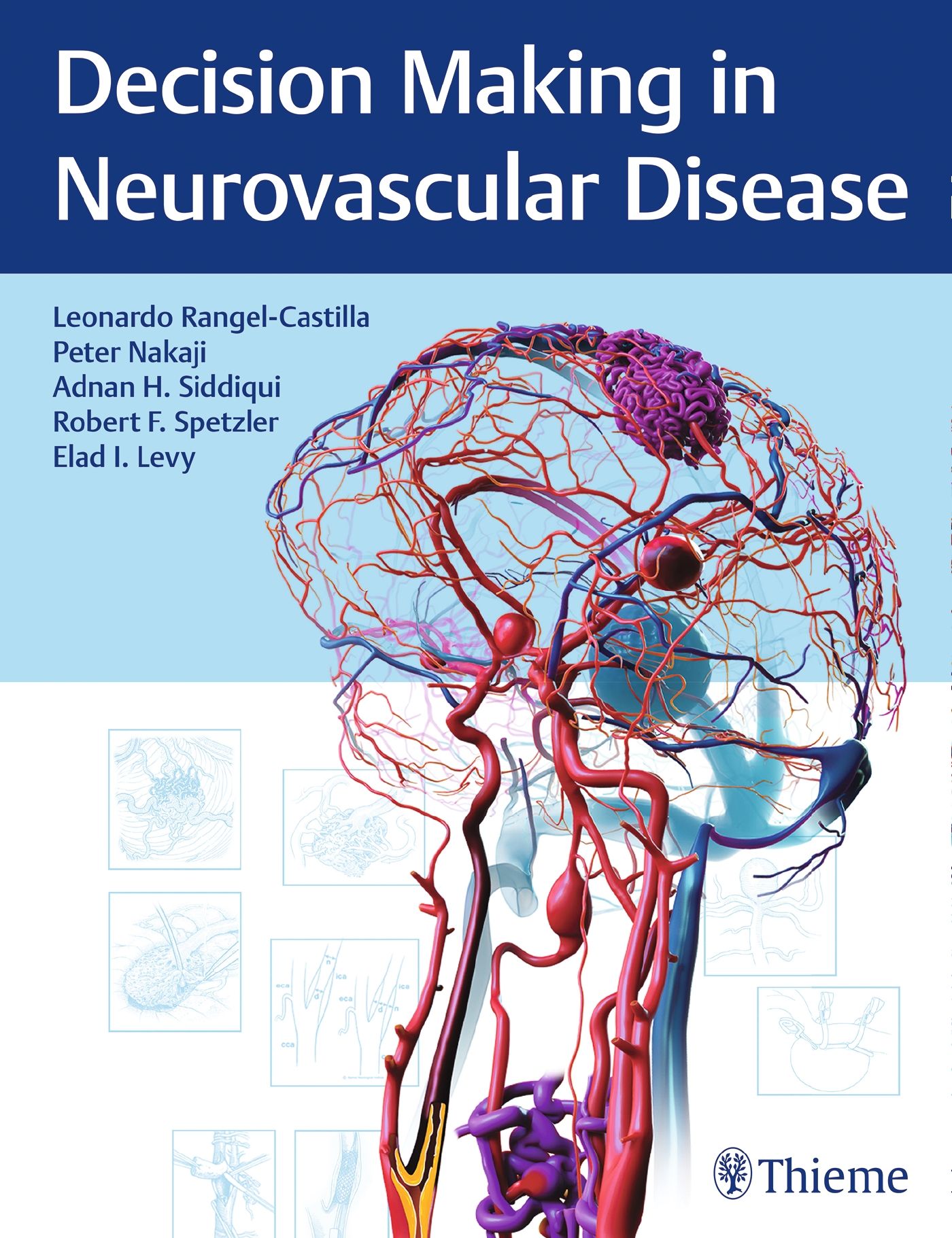 Decision Making in Neurovascular Disease 1 St - Shop Apotheke