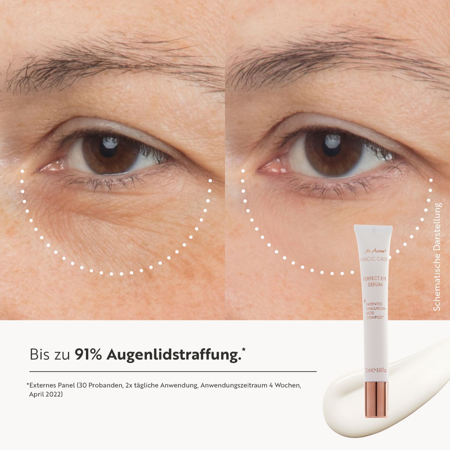 Vorher-Nachher-Vergleich von Augenpartien. Produktabbildung. Text: Bis zu 91% Augenlidstraffung.