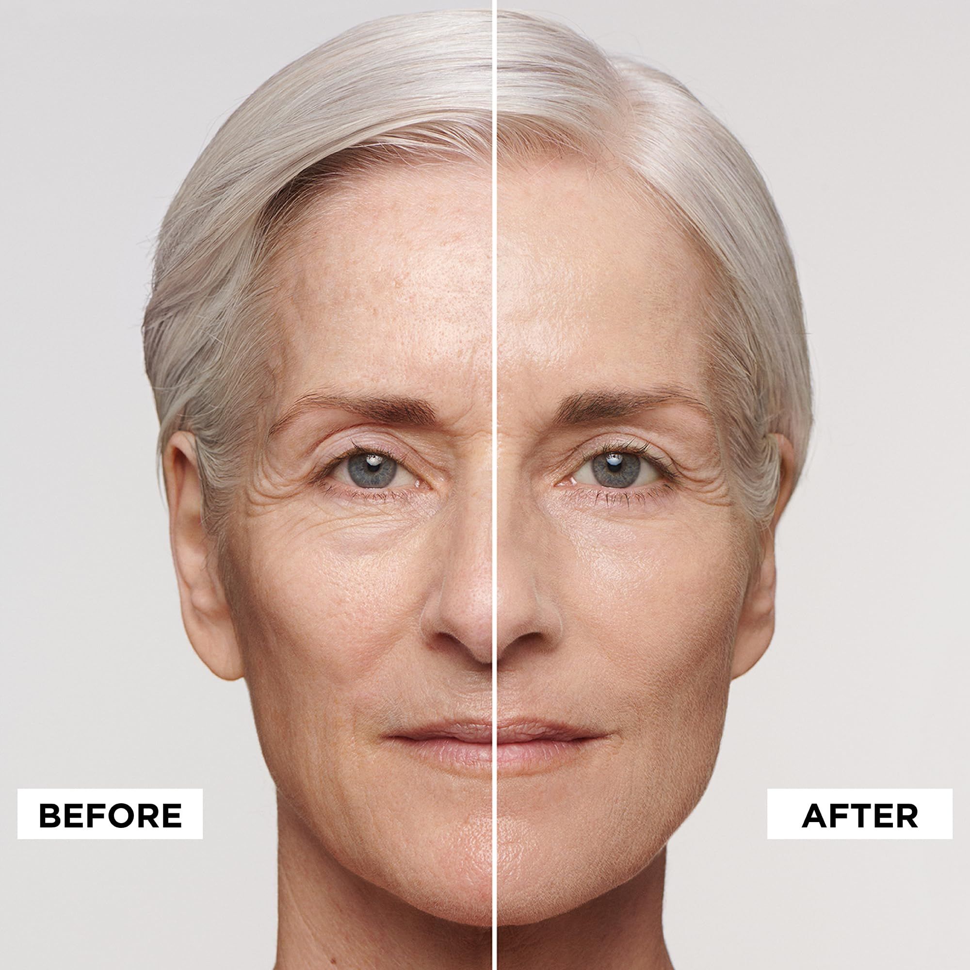 Gesicht, geteilt in Vorher-Nachher. Linke Gesichtshälfte: Vorher. Rechte Gesichtshälfte: Nachher. Deutliche Unterschiede.