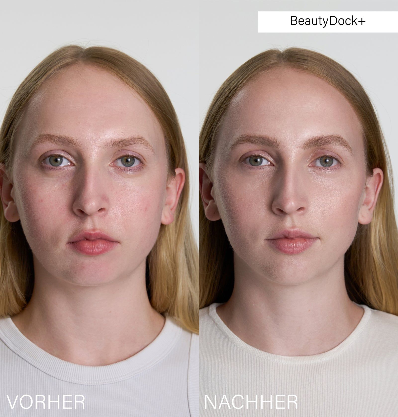 Vergleich von Gesichtern: Vorher und Nachher. BeautyDock+ beschriftet. Hautbild verbessert.