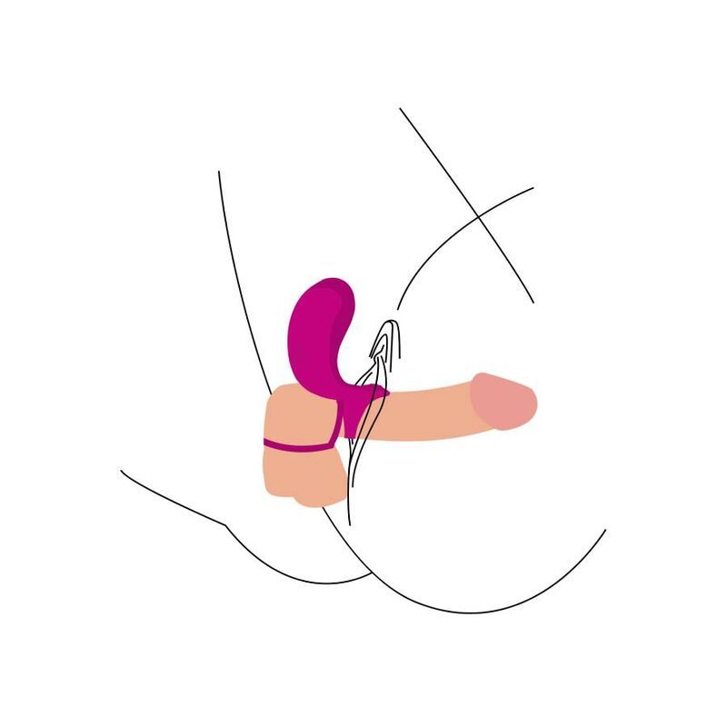 Illustration eines Penis mit einem Paar-Stimulationsring. Der Ring ist um den Penis gelegt. Eine weitere Linie zeigt die Positionierung.