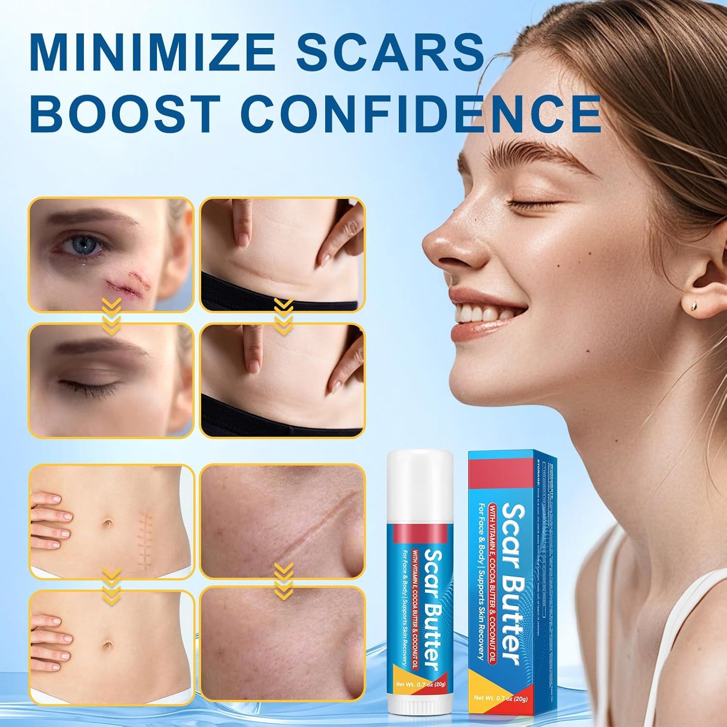 Frau mit "Scar Butter"-Stick. Vorher-Nachher-Bilder von Narben. Produktverpackung mit Produktnamen.