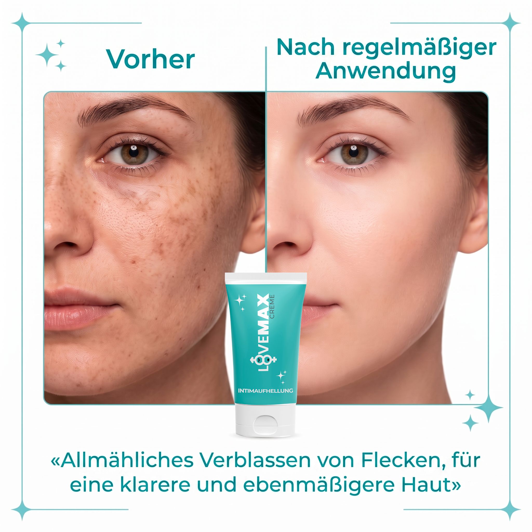 Vorher/Nachher-Vergleich: Gesicht mit Pigmentflecken und nach Anwendung der LOVEMAX Creme.