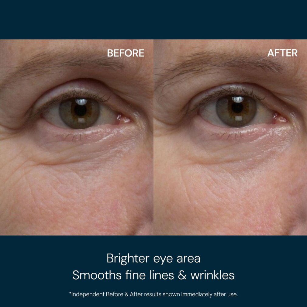 Vergleichsbild: Augenpartie vor und nach der Anwendung. Text: Brighter eye area, Smooths fine lines & wrinkles.