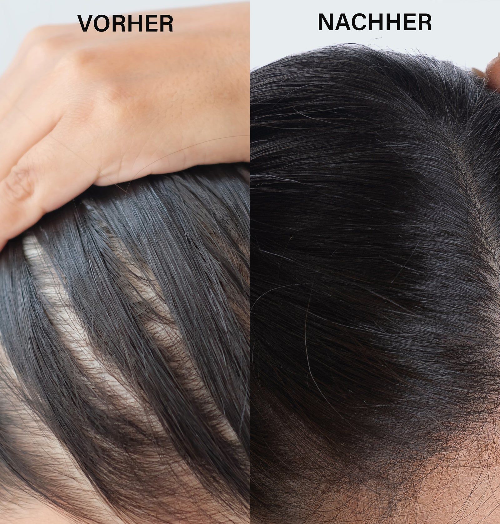 Vergleich von Kopfhaut und Haar vor und nach der Anwendung. Links: dünnes Haar. Rechts: volleres Haar. Text: Vorher/Nachher.