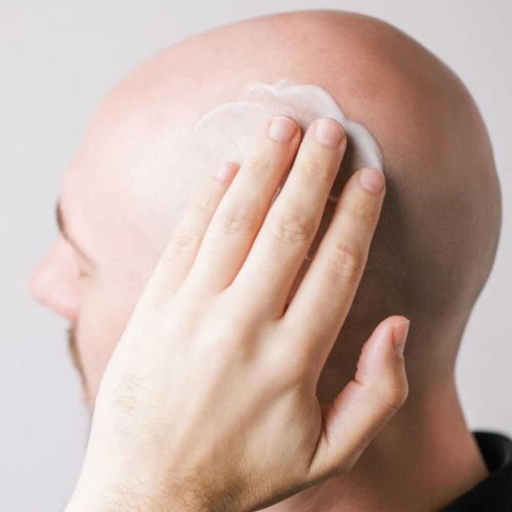 Mann mit glatt rasiertem Kopf. Hand trägt Creme auf. Hautkontakt. Helle Haut, dunkle Haare. Nahaufnahme, seitliche Ansicht.