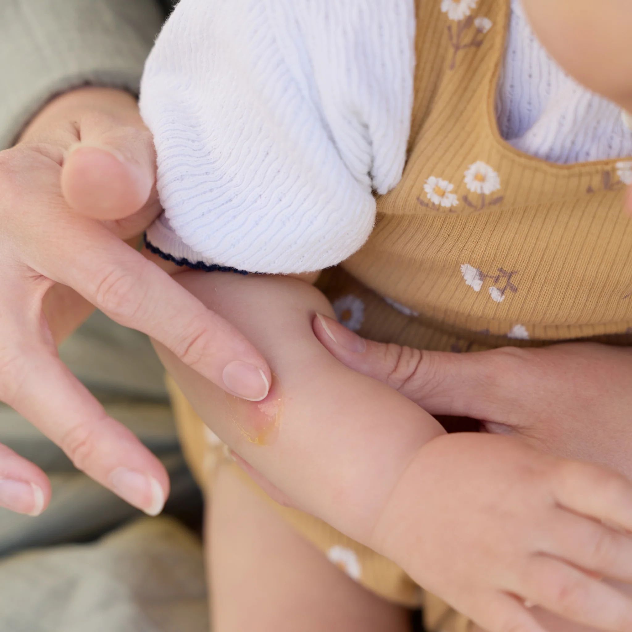 Eine Hand trägt MABYEN Insektenstich Gel auf den Arm eines Babys auf.
