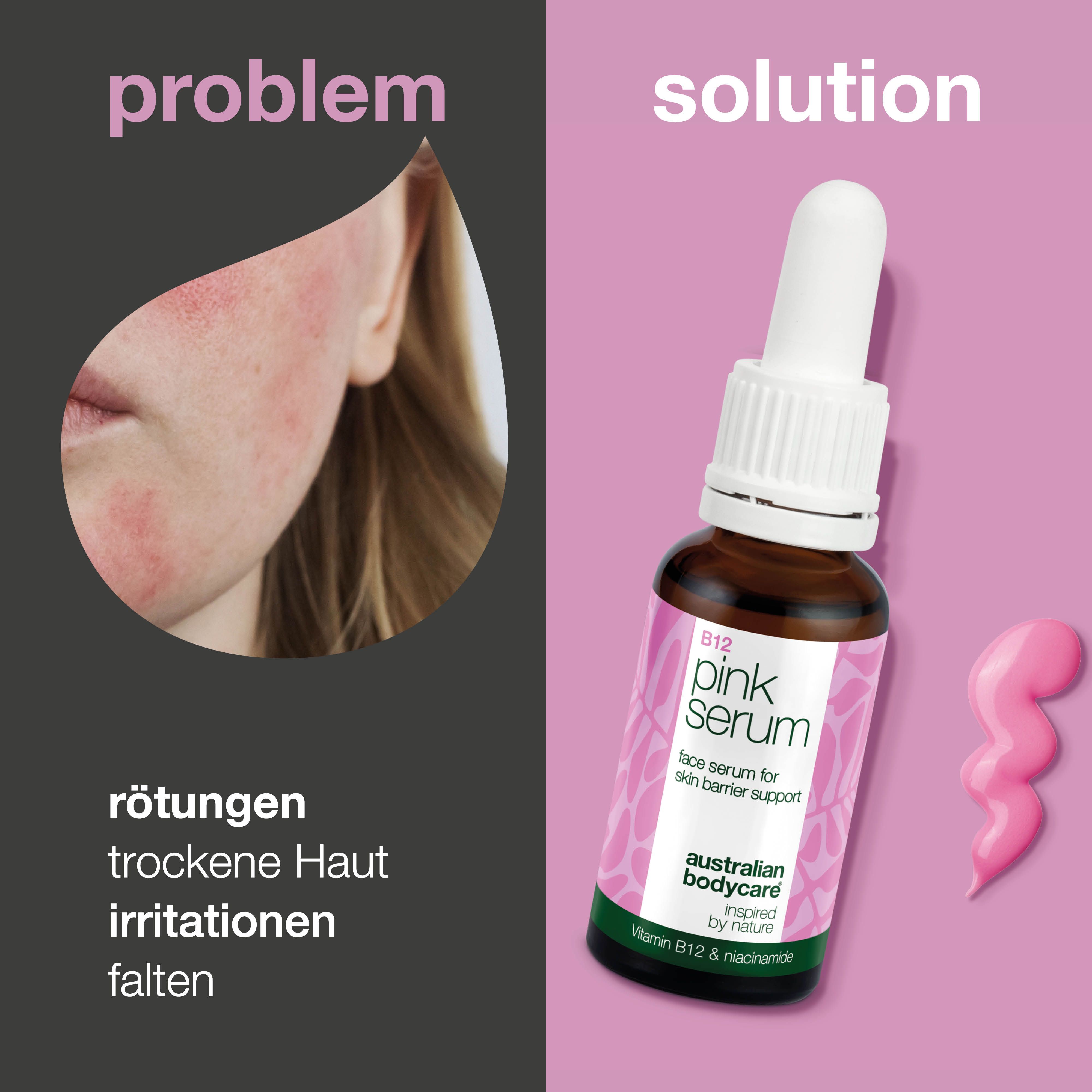 Gesicht mit Rötungen. Flasche "B12 pink Serum" neben rosa Serum-Klecks. Text: Problem/Lösung.