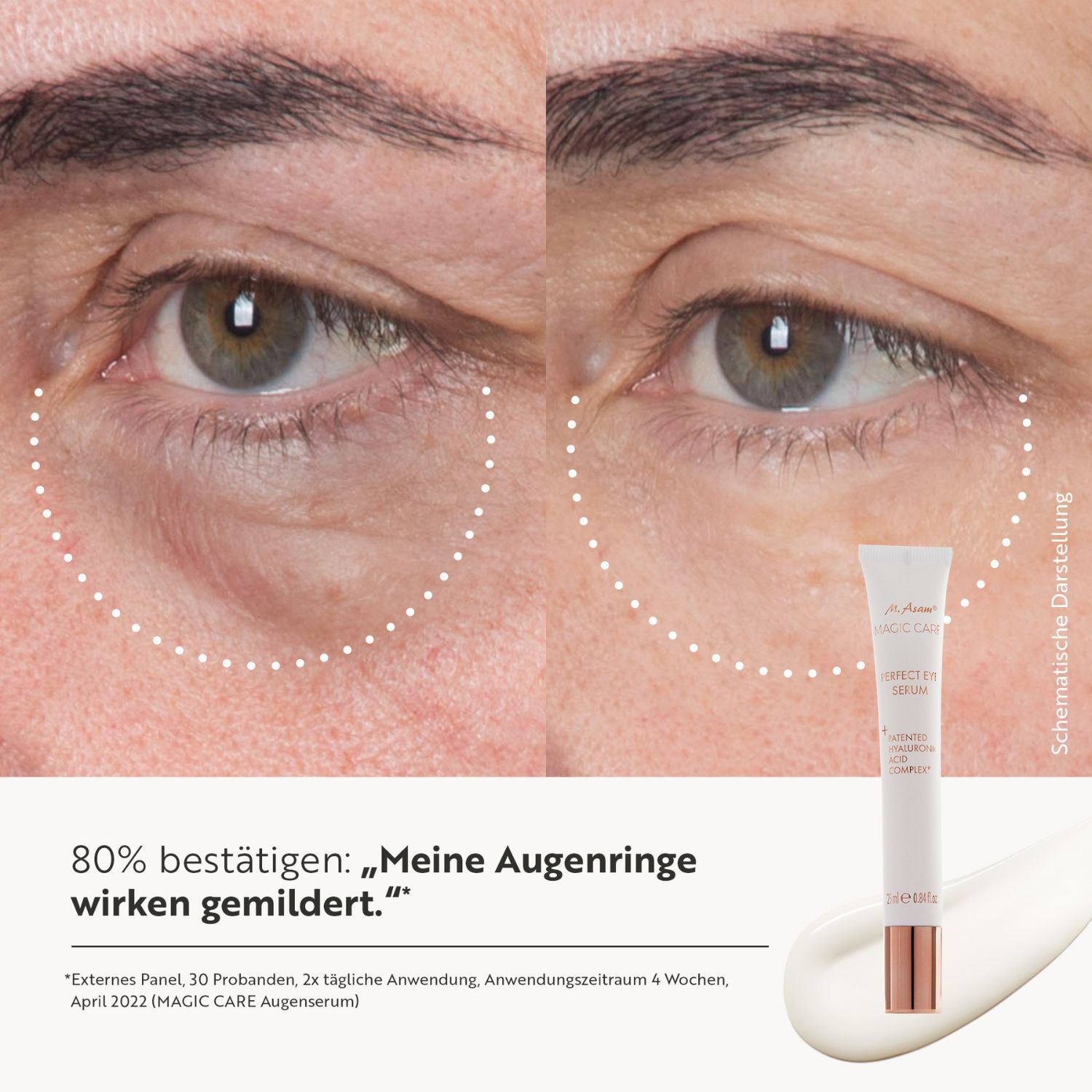 Vorher-Nachher-Vergleich von Augenpartien. Produktabbildung. Text: 80% bestätigen: „Meine Augenringe wirken gemildert.“