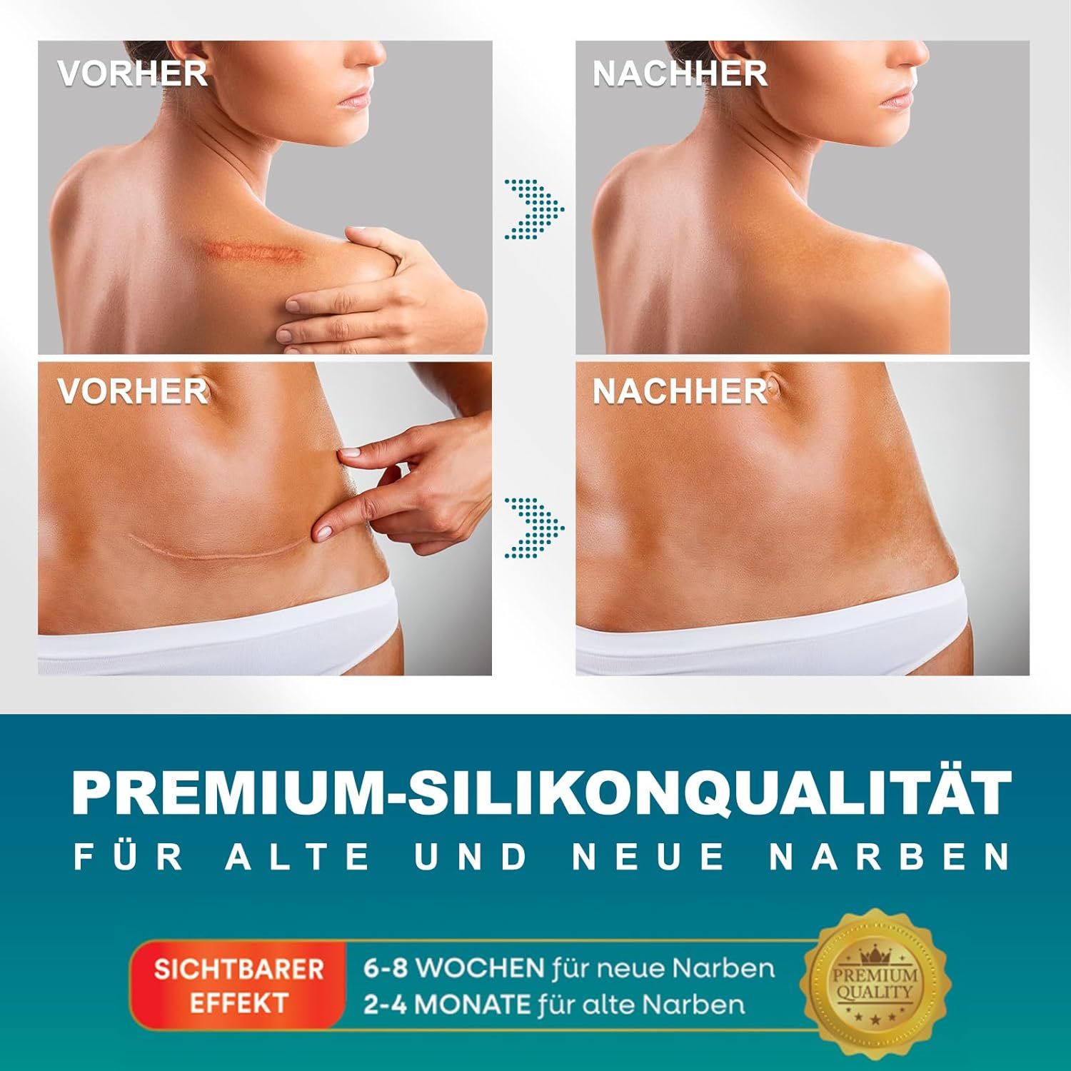 UNIEDI Narbenpflaster V2601-0007