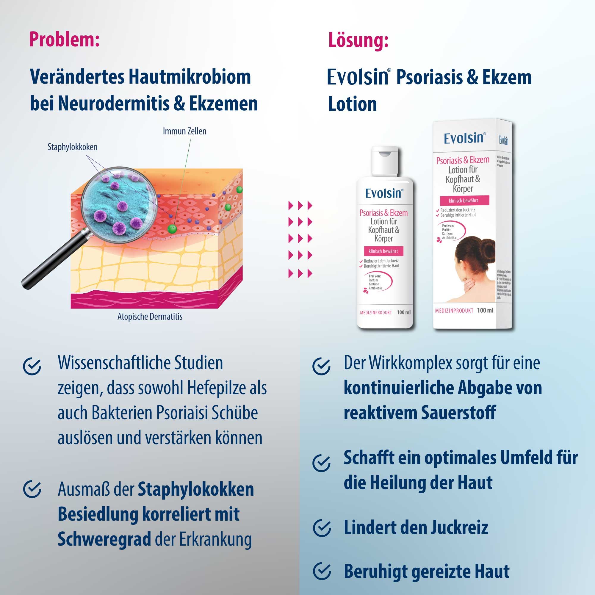 Grafik mit Hautschichten, Lupe, Flasche. Text: Lösung: Evolvsin Psoriasis & Ekzem Lotion. Reduziert Juckreiz, beruhigt gereizte Haut.