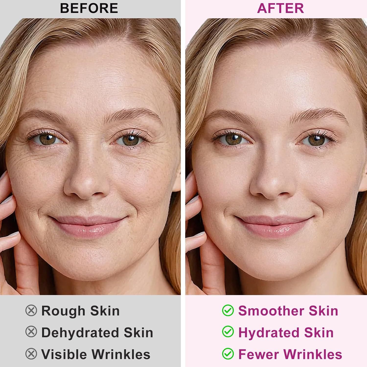 Abodiuss Wrinkle Patches für Gesicht