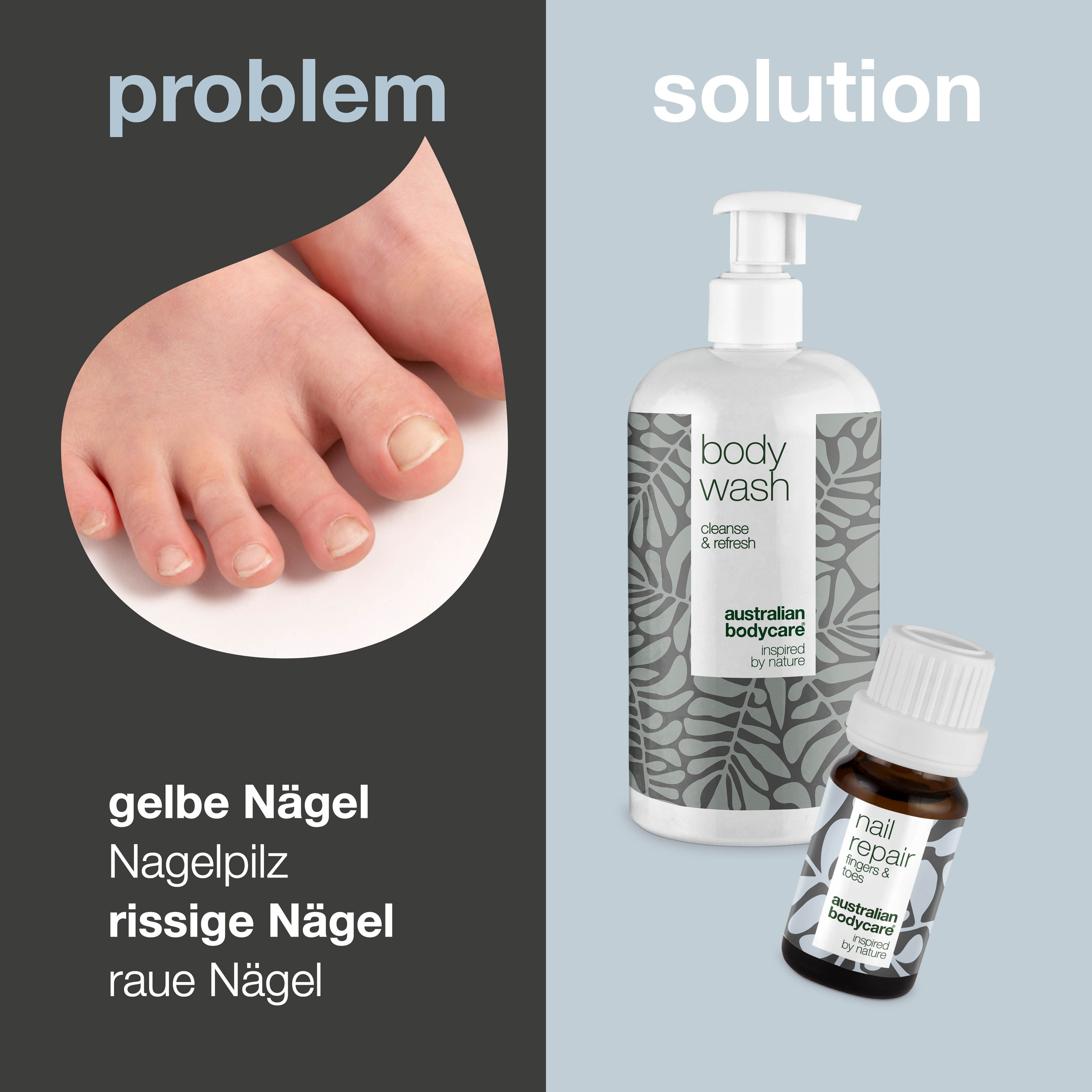 Vergleich von Problemen und Lösungen. Gelbe Nägel, Nagelpilz, rissige Nägel. Körperwaschmittel und Nagelöl.