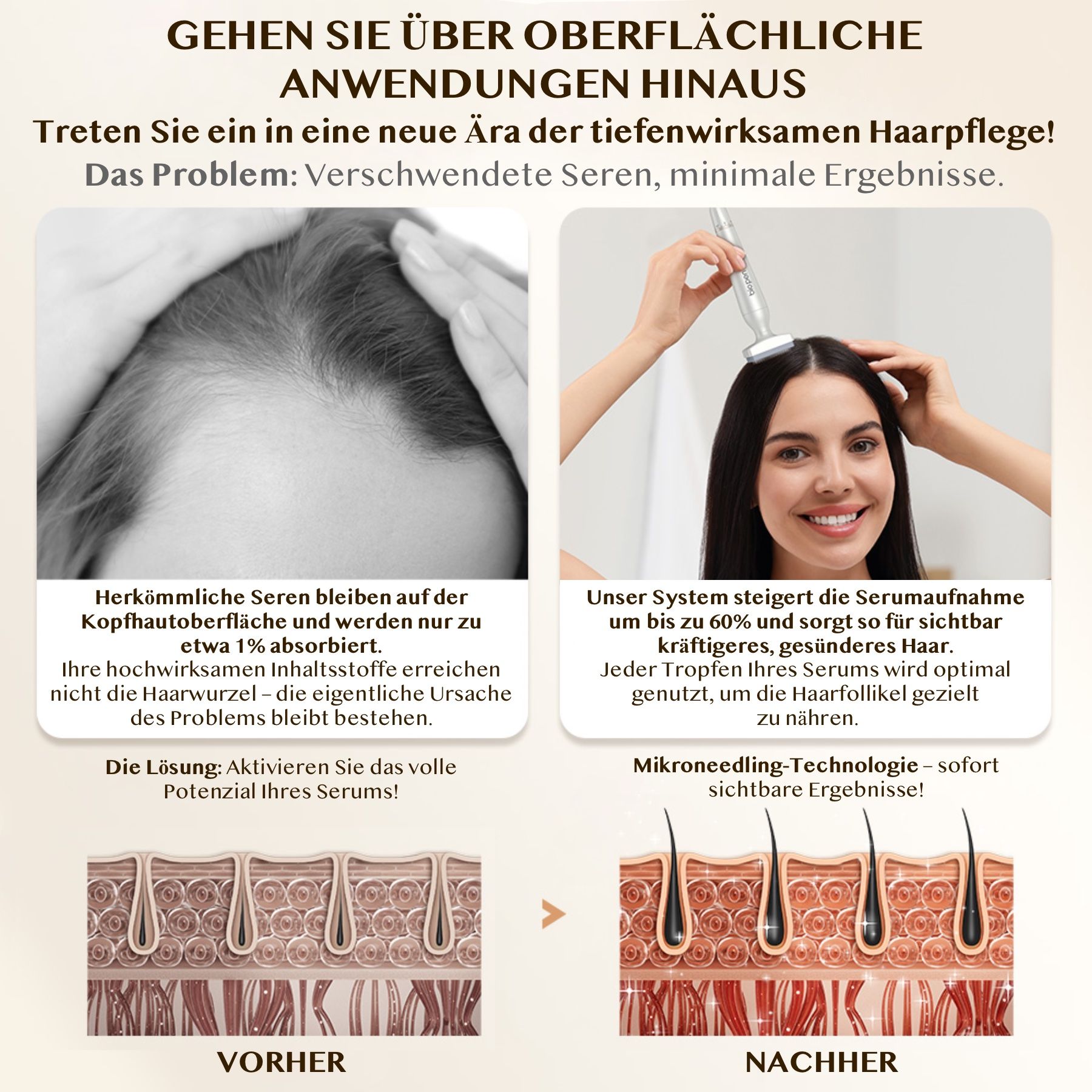 P-Beauty Dermaroller Bio Pen 4 Microneedling für Hautpflege