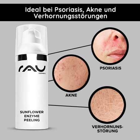 RAU Cosmetics Sunflower Enzyme Peeling  auf Basis von Hefeproteinen wirkt sanft und ohne Reibung