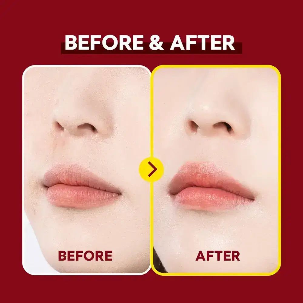 Vorher-Nachher-Vergleich. Lippenpartie. Links: Vorher. Rechts: Nachher. Gelber Rahmen.