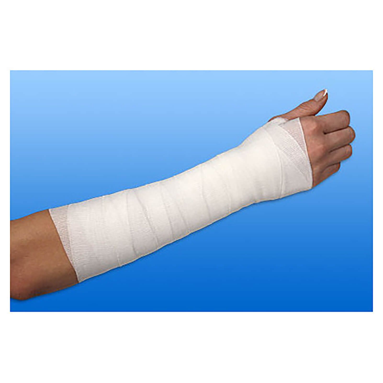 Arm mit weißer Mittelzugbinde gewickelt. Handgelenk und Unterarm bedeckt. Hintergrund blau.