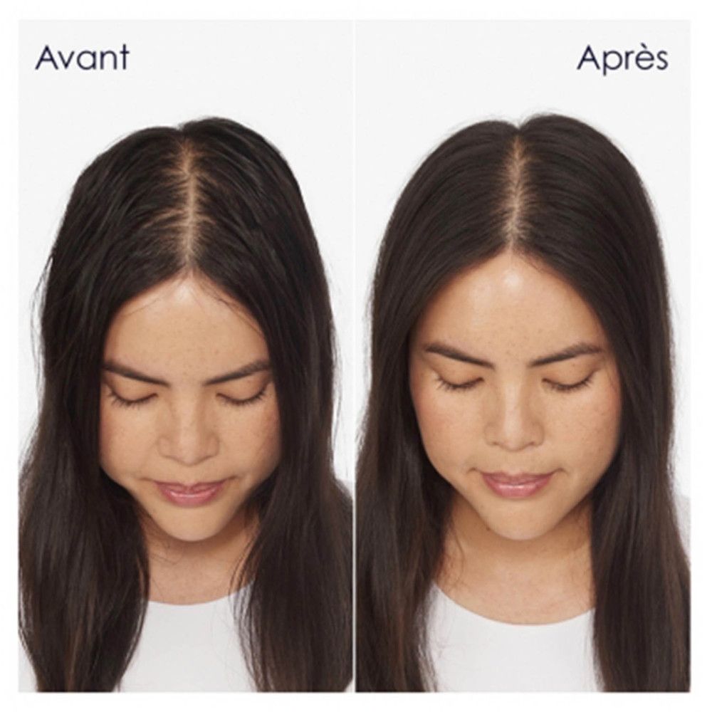 Zwei Frauen mit dunklem Haar. Links: Vorher. Rechts: Nachher. Haare sind weniger fettig.