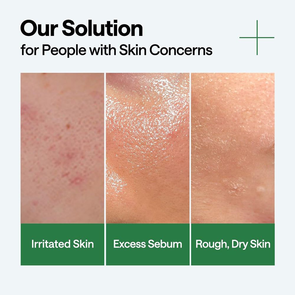 Drei Hautbilder: Irritierte Haut, überschüssiger Talg, raue, trockene Haut. Text: Our Solution for People with Skin Concerns.