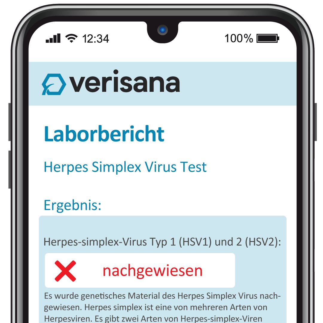 Verisana HSV Test Frau